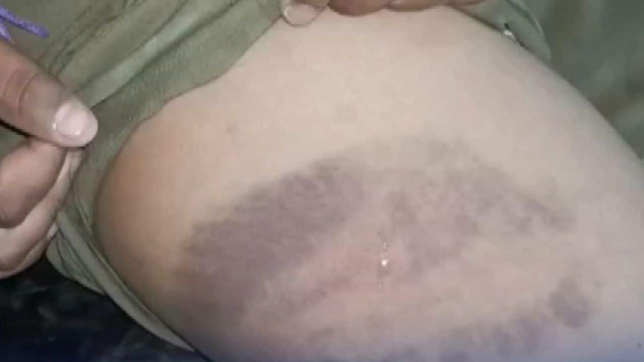 Тайский мальчик найден с синяками после того, как его избила бабушка