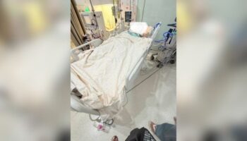 Бизнесмен остается без сознания спустя несколько дней после косметической операции