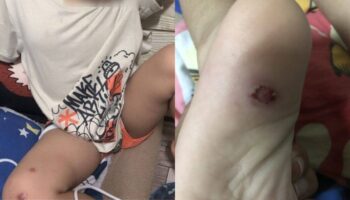 Тайский отчим арестован за убийственное нападение на трехлетнего мальчика