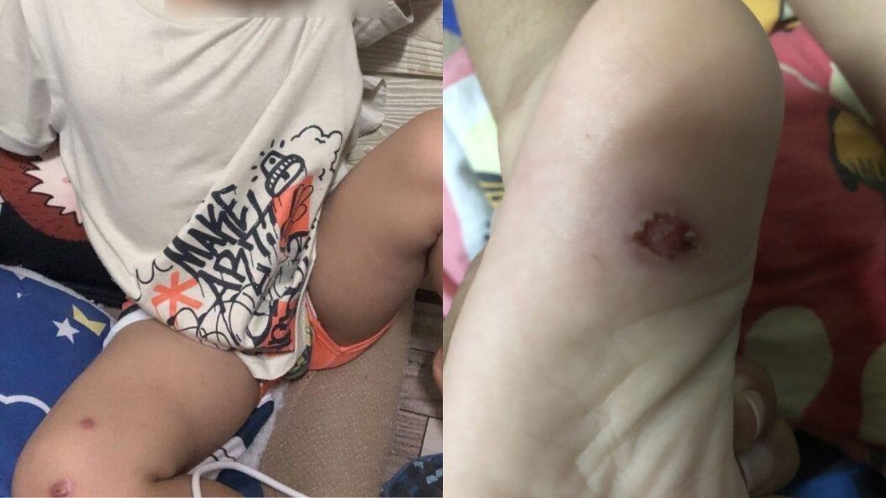 Тайский отчим арестован за убийственное нападение на трехлетнего мальчика