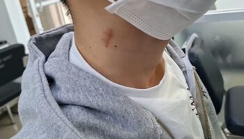 2 трансгендерные подозреваемые сдаются после того, как оставили сосок на шее жертвы