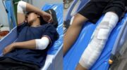 Иностранный гражданин остается на свободе после ранения подростка на Пхукете в результате наезда с последующим бегством.