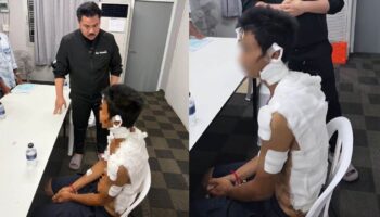 Мьянманец получил severe ожоги после предполагаемого нападения 6 китайских граждан