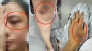 Тайская женщина сбегает из задержания и подвергается虐待 со стороны полицейского бойфренда