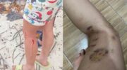 Иностранная женщина на Koh Pha Ngan, якобы ignoring жертву атаки собаки в Тайланде