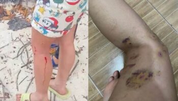 Иностранная женщина на Koh Pha Ngan, якобы ignoring жертву атаки собаки в Тайланде