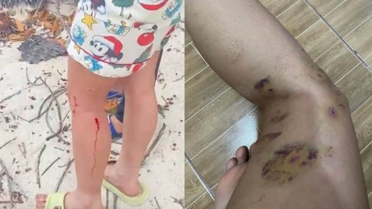 Иностранная женщина на Koh Pha Ngan, якобы ignoring жертву атаки собаки в Тайланде