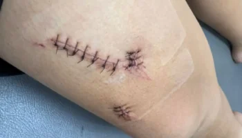 Тайская мать требует справедливости после того, как ее сын былstabbed одноклассником в школе Лампанга