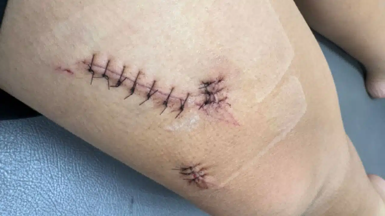 Тайская мать требует справедливости после того, как ее сын былstabbed одноклассником в школе Лампанга